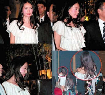 林志玲蔡依林揭秘明星尷尬的怪病