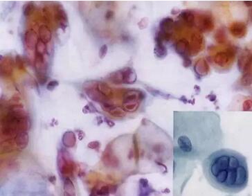 ϴӣךWMھϴOꑌҼ